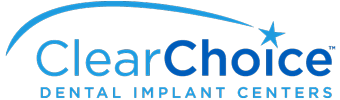 ClearChoice Dental Implant